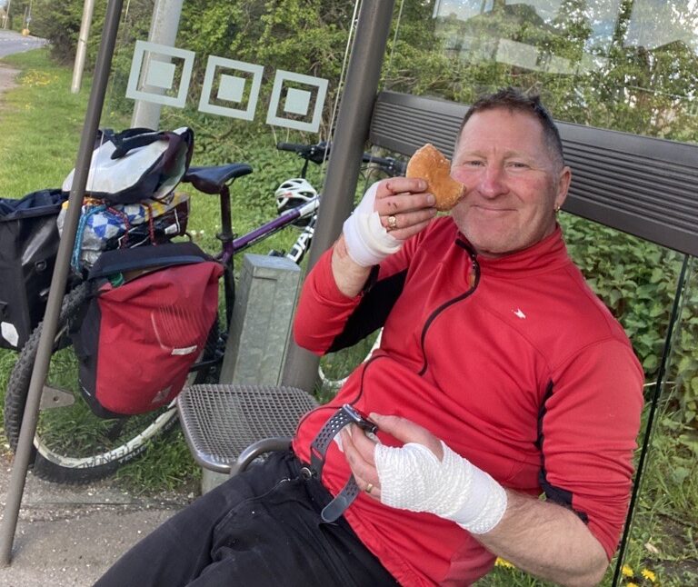 Chris sitting in a bus shelter with his hand bandaged eating a doughnut