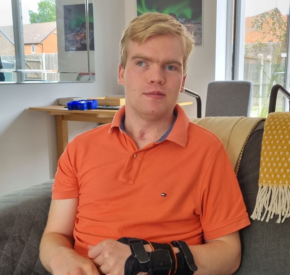 Ollie is sitting on a sofa, he is wearing an orange t shirt and a wrist support